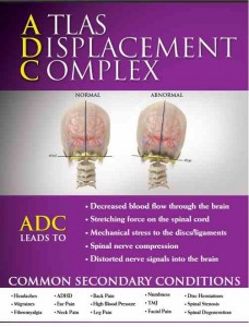 Atlas Displacement Complex